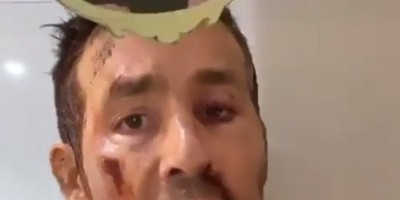 死侍测验IG迪士尼角色滤镜！结果出炉让他傻眼三秒